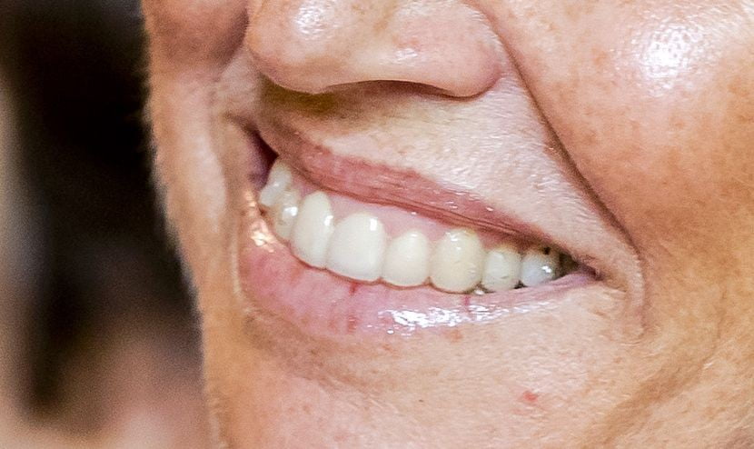 2017 maxima beugel anp